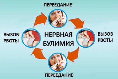 Лечение булимии в Кинешме